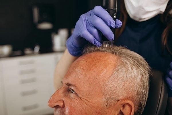 Hair Transplant Procedure Options, Costs, and More